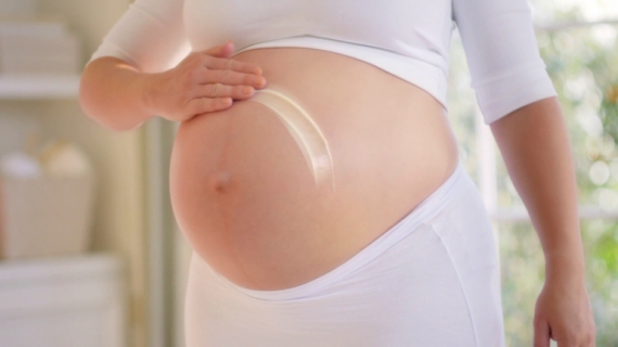 Palmer's Cocoa Butter Formula Massage Lotion for Stretch Marks