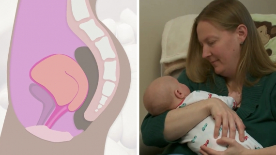 Postpartum Care: Changes in Your Body After Delivery