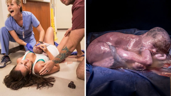 Powerful Photos From The 2018 Birth Photo Competition