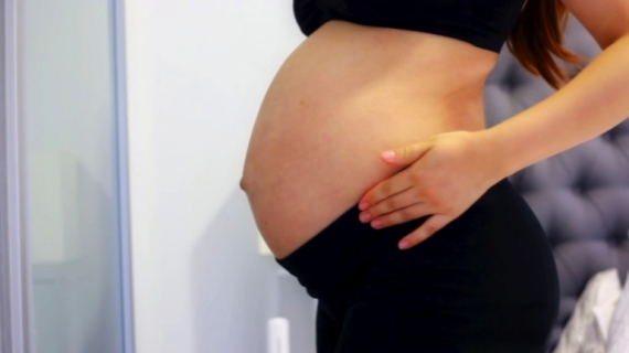 Pregnancy Hacks: How to Prevent Stretch Marks?