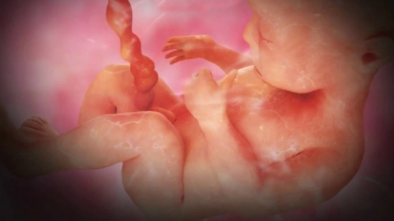 Pregnancy Week 20 - Five Months Pregnant