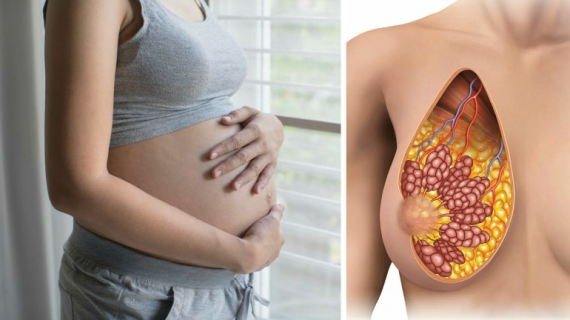 Pregnancy: Where Your Breast Milk Starts