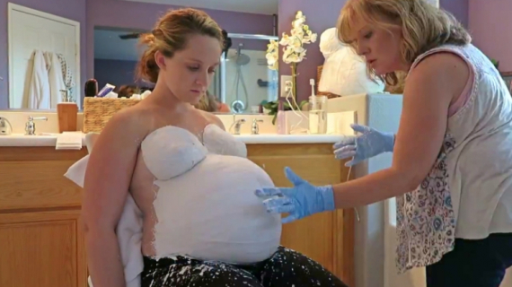 Pregnant Belly Casting