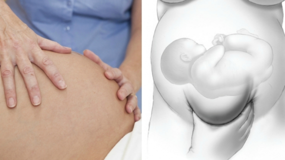 Prenatal Abdominal Examination: Leopold's Maneuvers Prenatal Abdominal Examination: Leopold's Maneuvers