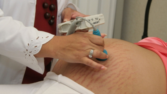 Risks and Benefits of VBAC and Planned C-Section