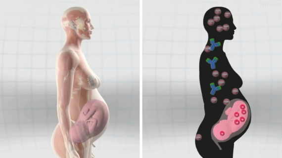 Secondhand Smoke Exposure During Pregnancy