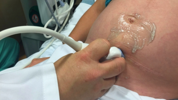 Should You Get Genetic Testing During Your Pregnancy?