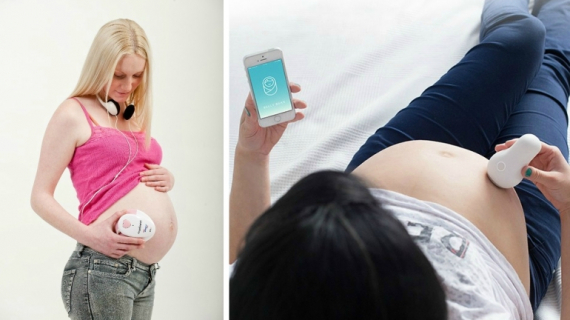 Should You Have an At-Home Fetal Monitor During Your Pregnancy?
