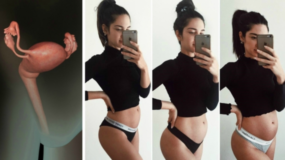 Smaller Baby Bump Due to Backwards Uterus?