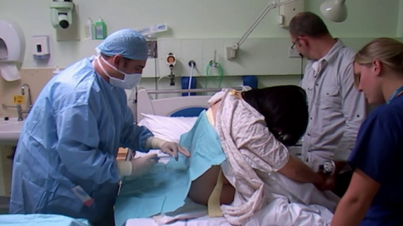 Step-by-Step Epidural Procedure for Labor