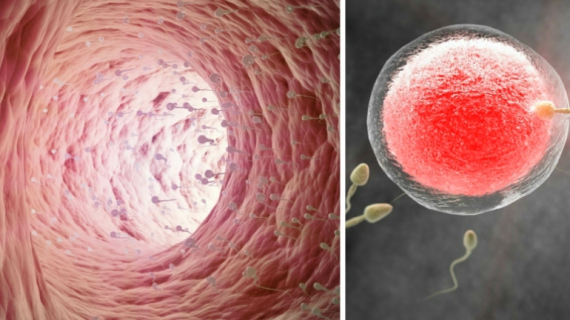 The Difficult Journey of the Sperm