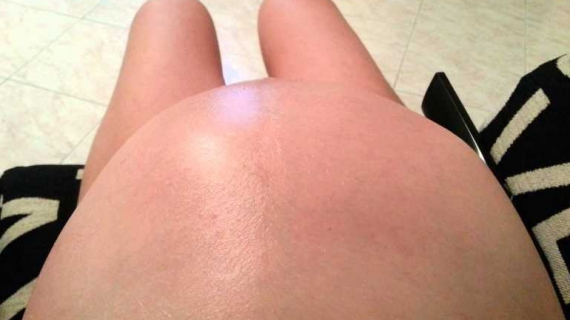 Unborn Baby Dances in Mom’s Swollen Belly