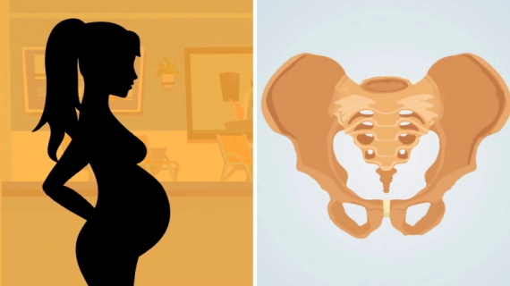 Ways to Ease Pelvic Pain During Pregnancy