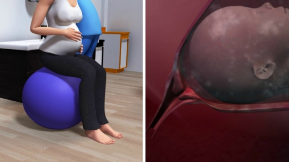 What Happens During a Vaginal Birth?