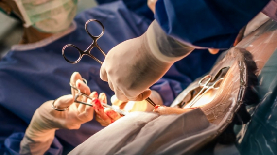 What Happens During an Emergency Caesarean Section?