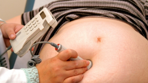 What Happens if You Go Over Dates or Are Overdue (VBAC)