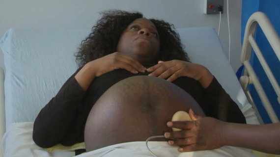 What is Induction of Labor and What is Involved?