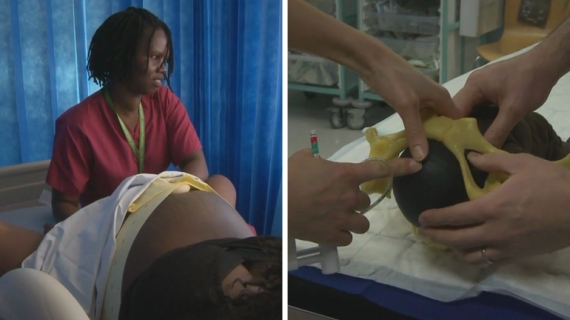 What is Involved in an Assisted Vaginal Delivery?