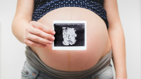 What is Prenatal Screening?