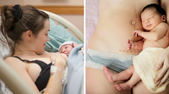 What to Expect After a Vaginal or Cesarean Birth?