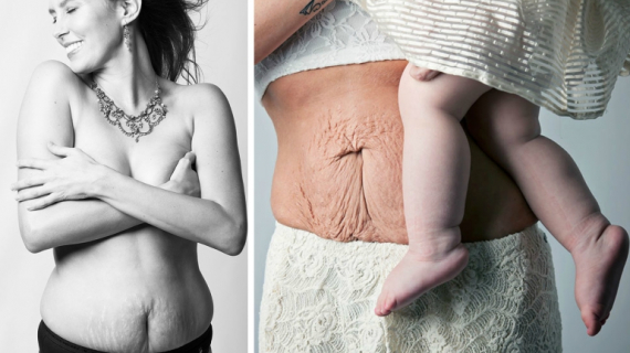 What Women's Bodies Really Look Like After Childbirth
