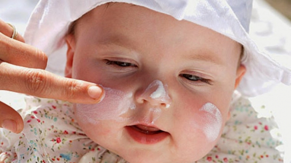 What You Need to Know About Baby Sunburn Treatment
