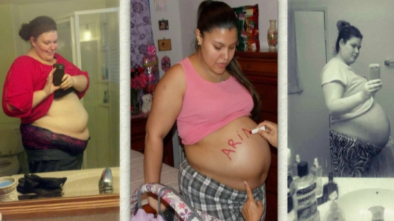 Plus Size Pregnancy: What’s a B Belly?