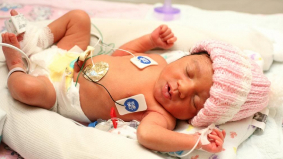 When Your Baby Has a Birth Defect?