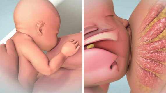 Why Breastfeeding in the First Hour of Life is Important?