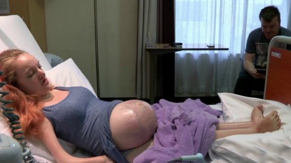 Young Woman Born With Virtually No Muscles Gives Birth To Miraculous Baby