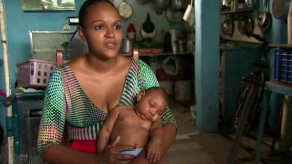 Zika Virus Linked to Birth Defect in Newborn Babies
