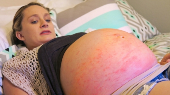 When You’re Afraid of Giving Birth